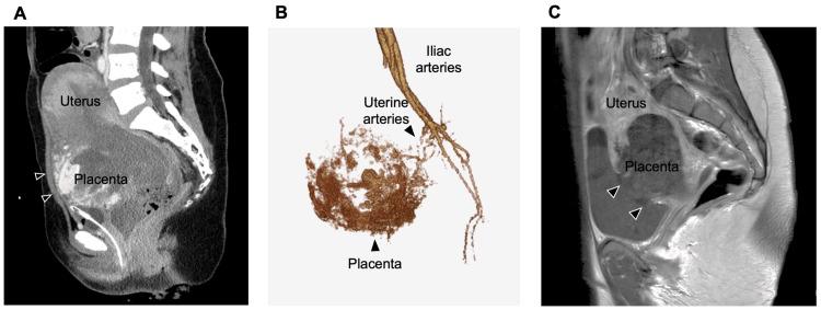 https://cdn.ncbi.nlm.nih.gov/pmc/blobs/9e1e/10995758/3e341a1cf9d9/cureus-0016-00000055651-i01.jpg