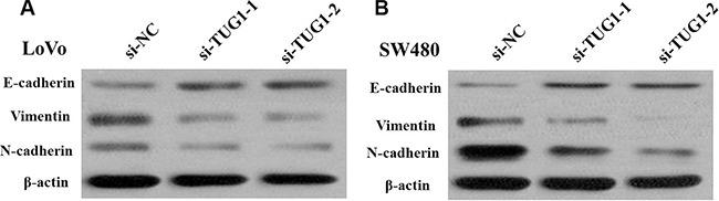 https://cdn.ncbi.nlm.nih.gov/pmc/blobs/9e1e/5239509/4217975f6d59/oncotarget-07-51713-g007.jpg