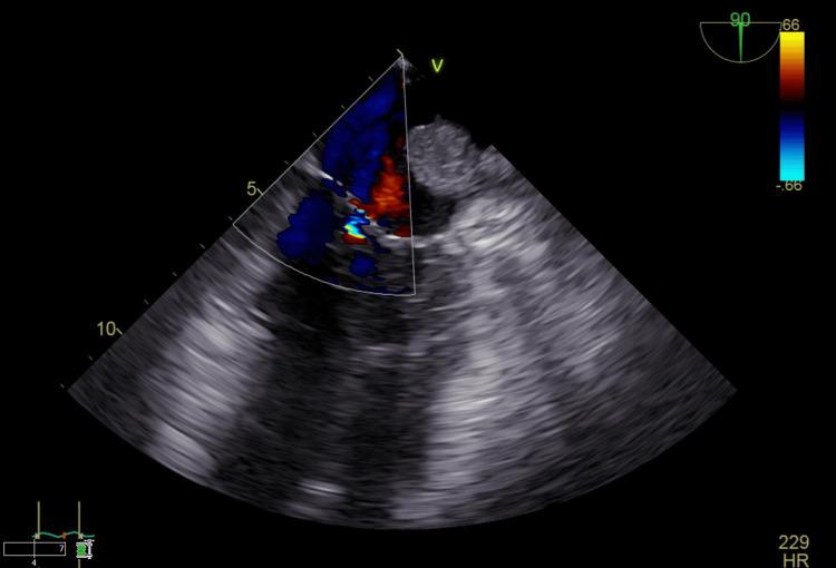 https://cdn.ncbi.nlm.nih.gov/pmc/blobs/9e1f/12442511/7d67557a7855/cureus-0017-00000090387-i03.jpg