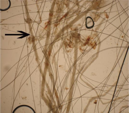 https://cdn.ncbi.nlm.nih.gov/pmc/blobs/9e23/11104042/505759d60a16/10.1177_1098612X14530215-fig6.jpg