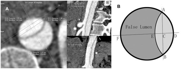 https://cdn.ncbi.nlm.nih.gov/pmc/blobs/9e25/3913653/dfa8e56300bf/pone.0087664.g001.jpg