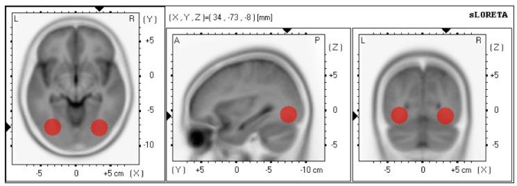 https://cdn.ncbi.nlm.nih.gov/pmc/blobs/9e25/4061891/3265419159c0/brainsci-03-01569-g001.jpg