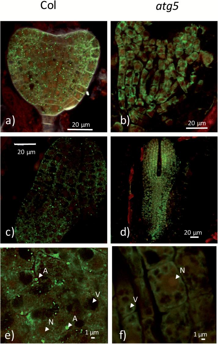 https://cdn.ncbi.nlm.nih.gov/pmc/blobs/9e26/6018931/6419c020b3b2/ery0121203.jpg