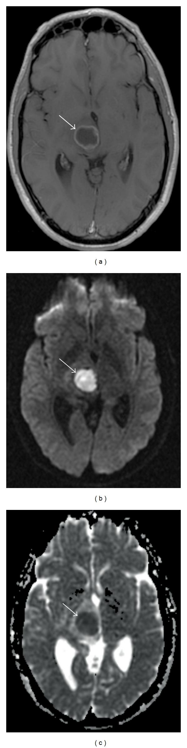 https://cdn.ncbi.nlm.nih.gov/pmc/blobs/9e2a/3202134/11ba814d5697/IJMI2011-714021.003.jpg