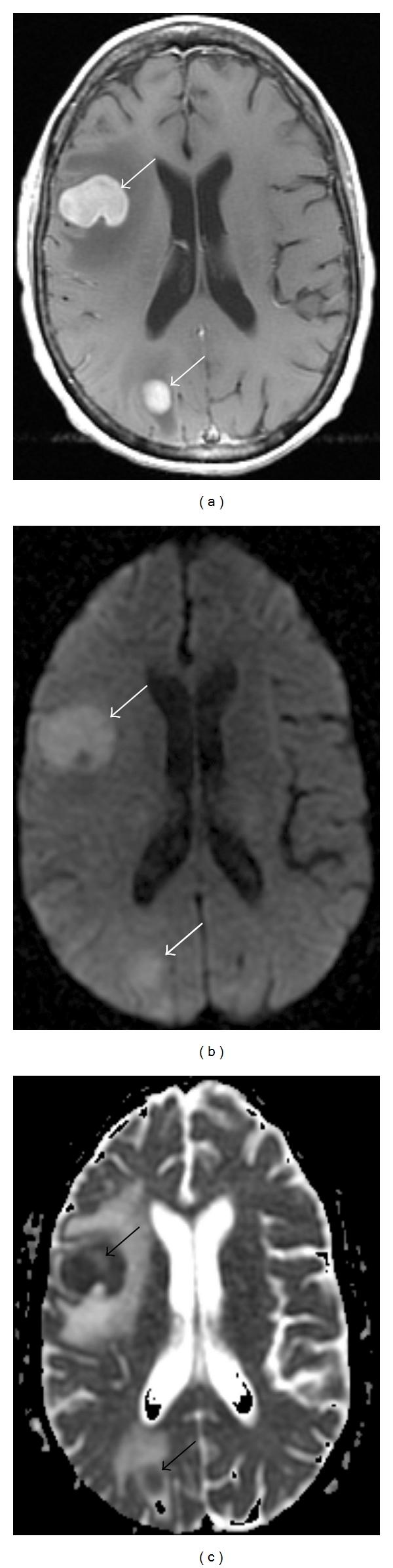 https://cdn.ncbi.nlm.nih.gov/pmc/blobs/9e2a/3202134/28077f201ba5/IJMI2011-714021.004.jpg