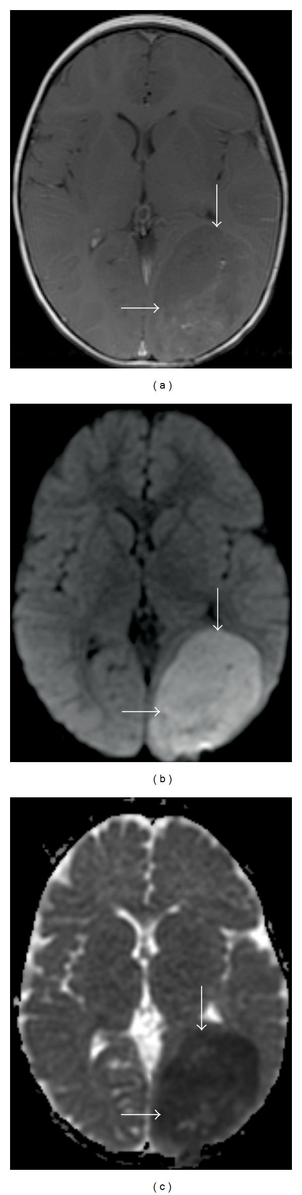 https://cdn.ncbi.nlm.nih.gov/pmc/blobs/9e2a/3202134/4660af028125/IJMI2011-714021.005.jpg