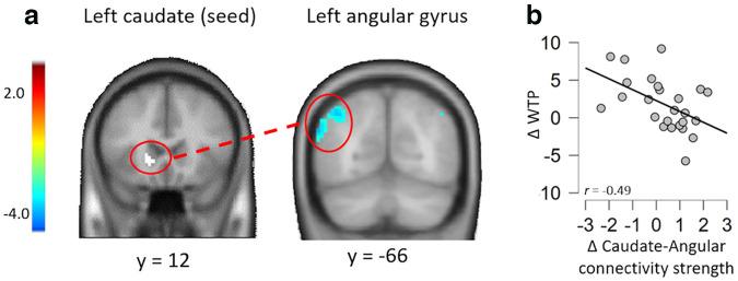 https://cdn.ncbi.nlm.nih.gov/pmc/blobs/9e2b/9374136/8e978c058d6a/SN-JNSJ220442F008.jpg