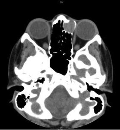 https://cdn.ncbi.nlm.nih.gov/pmc/blobs/9e2c/3789634/46f847950a2e/rjt00204.jpg