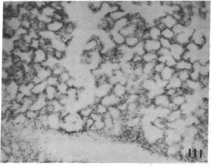 https://cdn.ncbi.nlm.nih.gov/pmc/blobs/9e30/443387/0126538b6426/jcinvest00054-0199-g.jpg