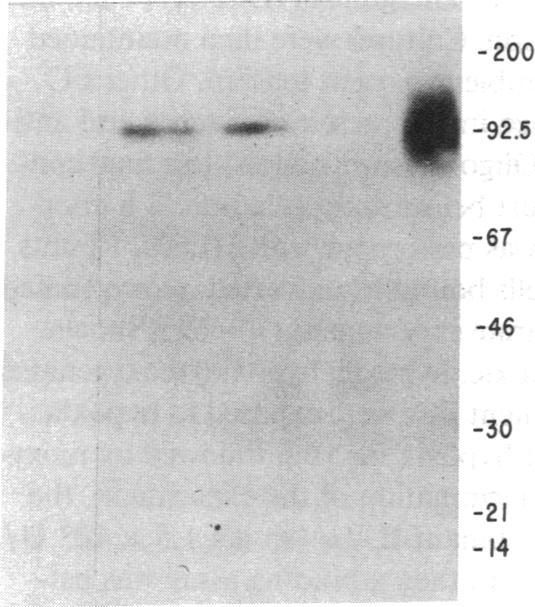 https://cdn.ncbi.nlm.nih.gov/pmc/blobs/9e30/443387/10bc986a3eb7/jcinvest00054-0197-b.jpg