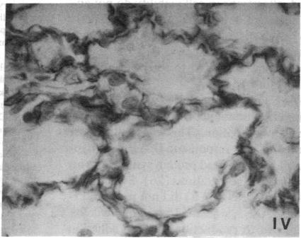 https://cdn.ncbi.nlm.nih.gov/pmc/blobs/9e30/443387/43044354da60/jcinvest00054-0199-f.jpg