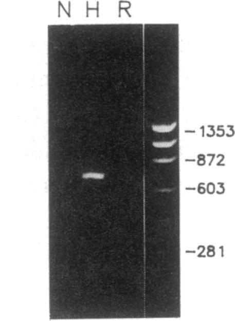 https://cdn.ncbi.nlm.nih.gov/pmc/blobs/9e30/443387/b88a4897b640/jcinvest00054-0196-a.jpg