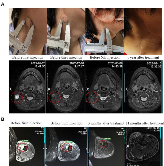 https://cdn.ncbi.nlm.nih.gov/pmc/blobs/9e31/12142144/94c06bf2beb1/jitc-13-6-g004.jpg