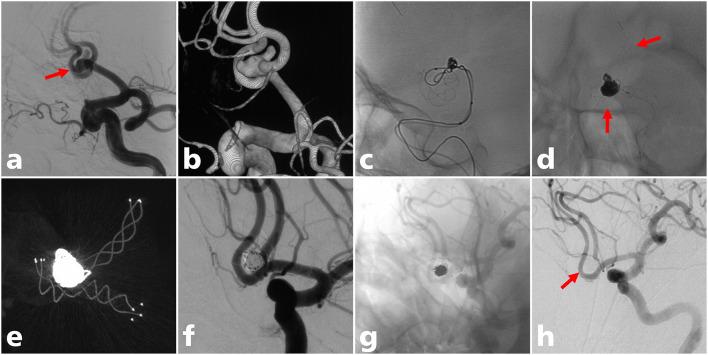 https://cdn.ncbi.nlm.nih.gov/pmc/blobs/9e39/7876256/cc8b31ed0f36/fneur-11-611875-g0002.jpg