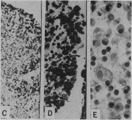 https://cdn.ncbi.nlm.nih.gov/pmc/blobs/9e3c/1946166/39c188619f7a/canmedaj01322-0028-c.jpg
