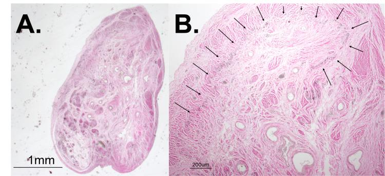 https://cdn.ncbi.nlm.nih.gov/pmc/blobs/9e3f/12034318/3f11ed005b20/cureus-0017-00000081366-i04.jpg