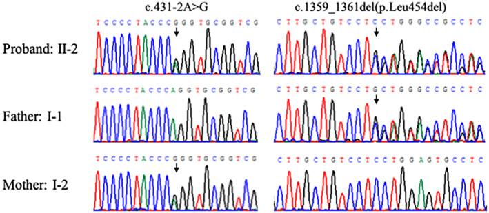 https://cdn.ncbi.nlm.nih.gov/pmc/blobs/9e49/9834191/26163c8f3564/MGG3-11-e2092-g003.jpg