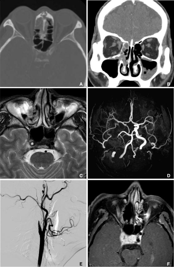 https://cdn.ncbi.nlm.nih.gov/pmc/blobs/9e50/3299950/b340348e97b8/ni-7-45-g001.jpg