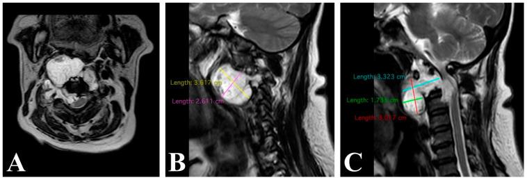 https://cdn.ncbi.nlm.nih.gov/pmc/blobs/9e52/10968869/3512e93f4eb5/brainsci-14-00254-g005.jpg