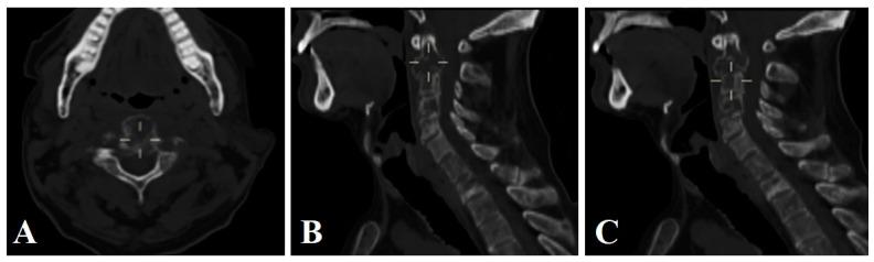https://cdn.ncbi.nlm.nih.gov/pmc/blobs/9e52/10968869/a4b476775c8c/brainsci-14-00254-g003.jpg
