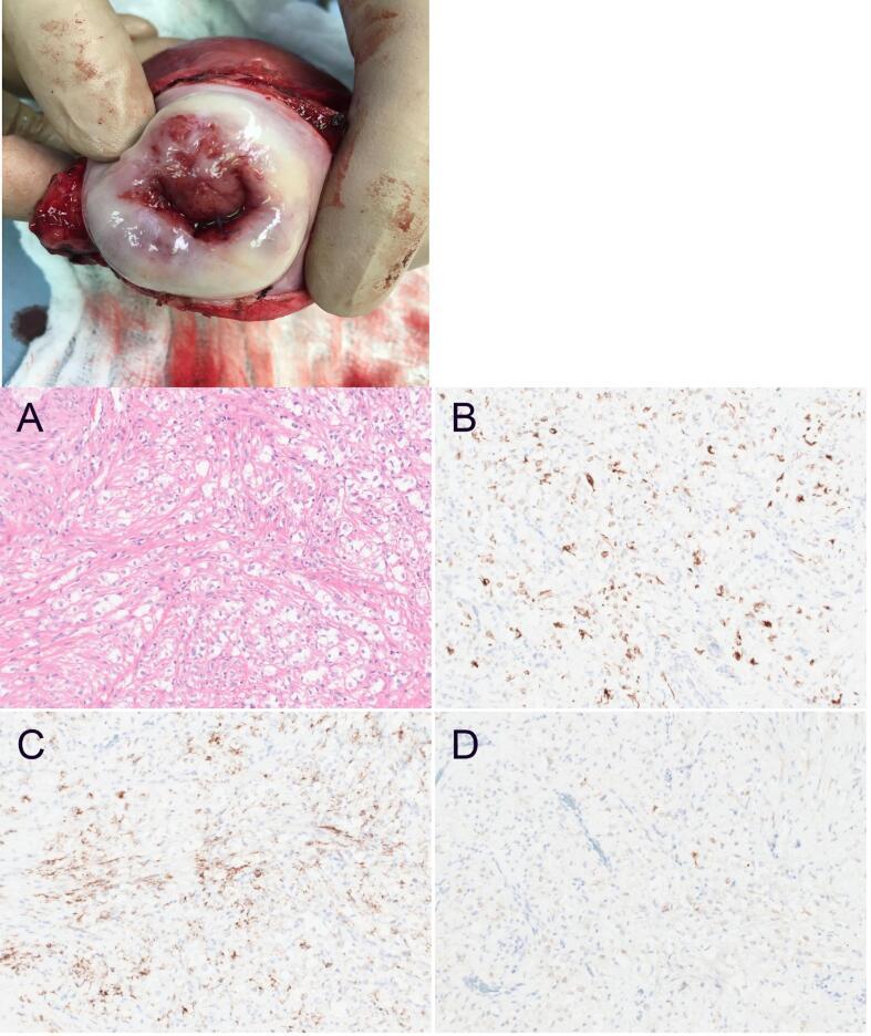 https://cdn.ncbi.nlm.nih.gov/pmc/blobs/9e53/10368816/627013d770cb/gr1.jpg