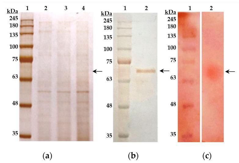 https://cdn.ncbi.nlm.nih.gov/pmc/blobs/9e56/9782813/f76409f9c91e/molecules-27-08922-g003.jpg
