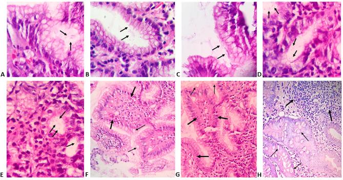 https://cdn.ncbi.nlm.nih.gov/pmc/blobs/9e60/8314390/78076fa82cc3/ejh-65-3-3222-g001.jpg