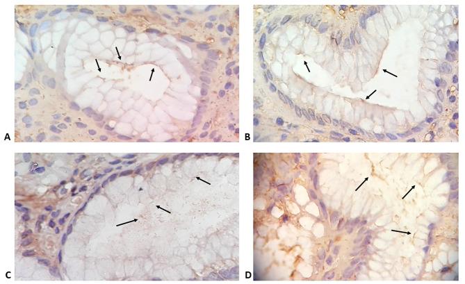 https://cdn.ncbi.nlm.nih.gov/pmc/blobs/9e60/8314390/c75f9840de8e/ejh-65-3-3222-g003.jpg