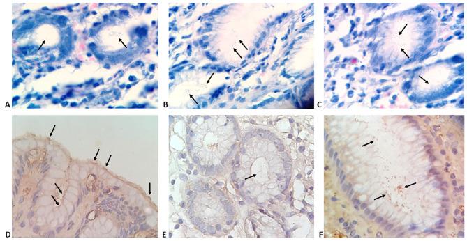 https://cdn.ncbi.nlm.nih.gov/pmc/blobs/9e60/8314390/d11692df2499/ejh-65-3-3222-g002.jpg