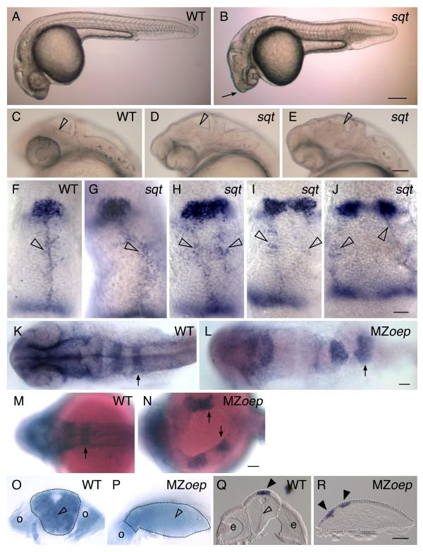 https://cdn.ncbi.nlm.nih.gov/pmc/blobs/9e62/2214732/d8c02b9e1632/1471-213X-7-126-3.jpg