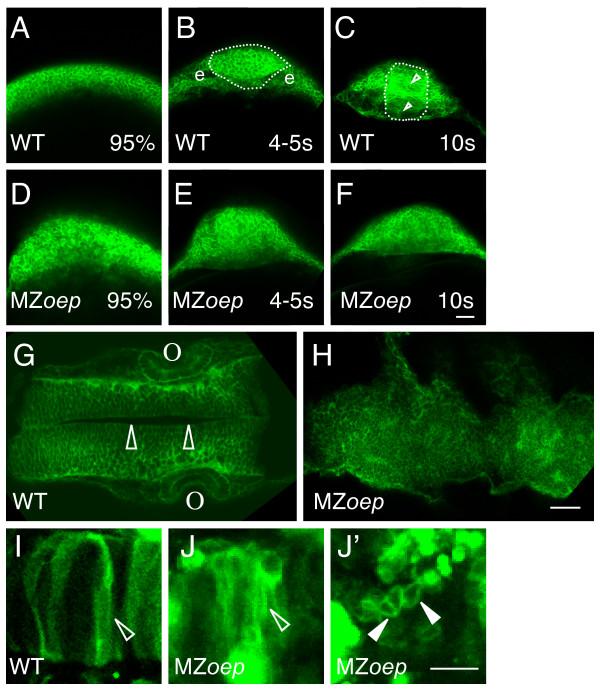 https://cdn.ncbi.nlm.nih.gov/pmc/blobs/9e62/2214732/ed4c42520c78/1471-213X-7-126-6.jpg