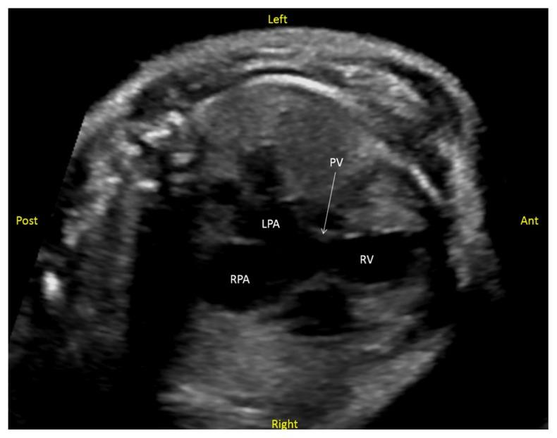 https://cdn.ncbi.nlm.nih.gov/pmc/blobs/9e62/7006829/39402ad7c5c3/kjm-13-21f1.jpg