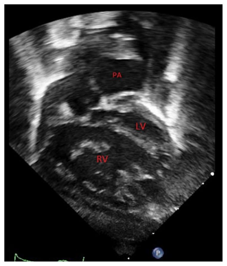 https://cdn.ncbi.nlm.nih.gov/pmc/blobs/9e62/7006829/f8a2e4d88767/kjm-13-21f2.jpg