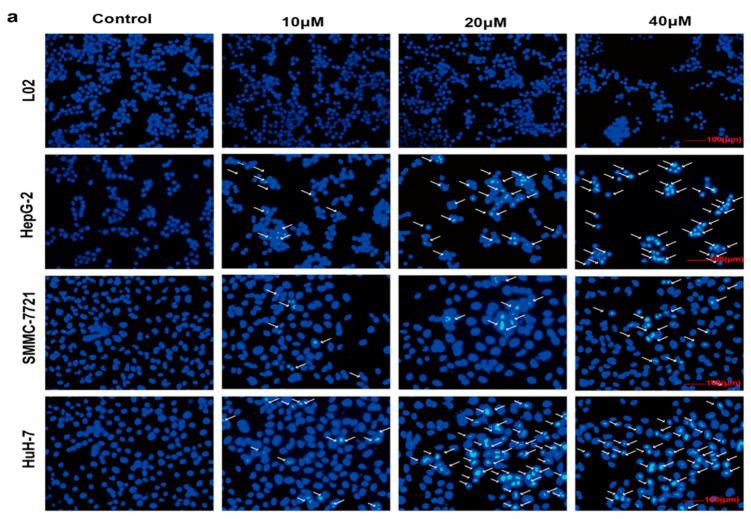 https://cdn.ncbi.nlm.nih.gov/pmc/blobs/9e64/8003055/025c6d56ab69/ijms-22-03097-g003a.jpg