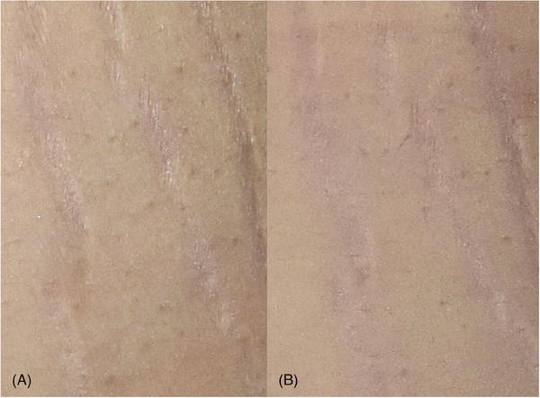 https://cdn.ncbi.nlm.nih.gov/pmc/blobs/9e66/10788582/f12e5ef9fa53/SRT-30-e13551-g003.jpg