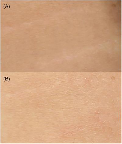 https://cdn.ncbi.nlm.nih.gov/pmc/blobs/9e66/10788582/f5bf4926d0f2/SRT-30-e13551-g007.jpg