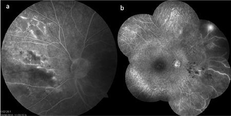 https://cdn.ncbi.nlm.nih.gov/pmc/blobs/9e69/7338748/c56039b615b8/TJO-50-169-g8.jpg