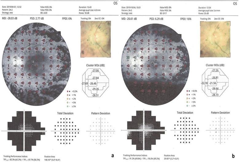 https://cdn.ncbi.nlm.nih.gov/pmc/blobs/9e6f/6958670/09091a512d5d/13287_2020_1549_Fig3_HTML.jpg