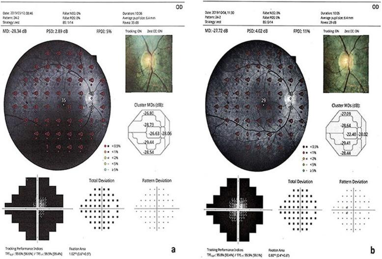 https://cdn.ncbi.nlm.nih.gov/pmc/blobs/9e6f/6958670/4b87e86b3609/13287_2020_1549_Fig2_HTML.jpg