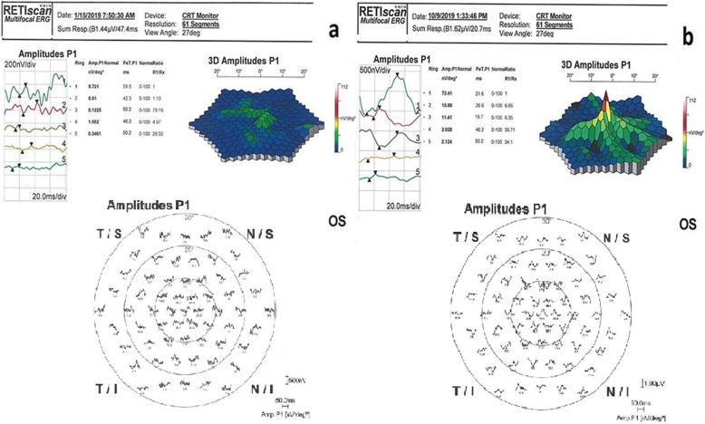 https://cdn.ncbi.nlm.nih.gov/pmc/blobs/9e6f/6958670/98ff1a6ecb9b/13287_2020_1549_Fig6_HTML.jpg