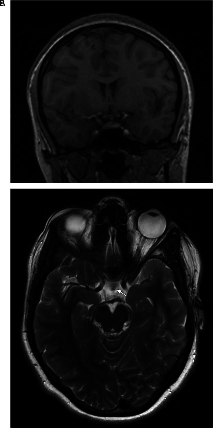 https://cdn.ncbi.nlm.nih.gov/pmc/blobs/9e6f/9125064/04c60f80625b/10.1177_2329048X221103051-fig1.jpg
