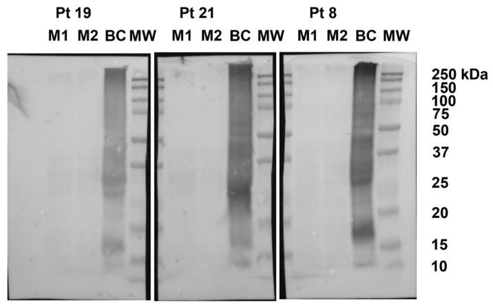 https://cdn.ncbi.nlm.nih.gov/pmc/blobs/9e70/8709061/67e73d99826f/nutrients-13-04540-g002.jpg