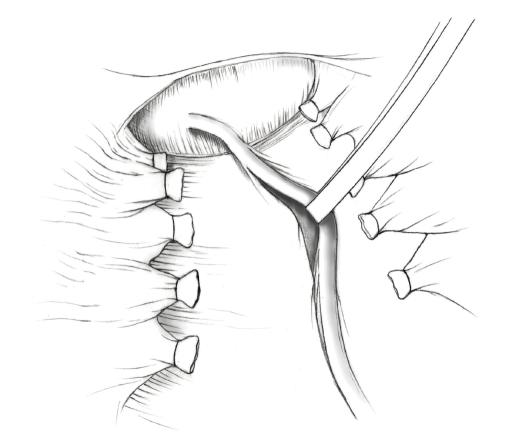 https://cdn.ncbi.nlm.nih.gov/pmc/blobs/9e78/2939408/1bc362a5e1f0/OGI2010-587610.013.jpg
