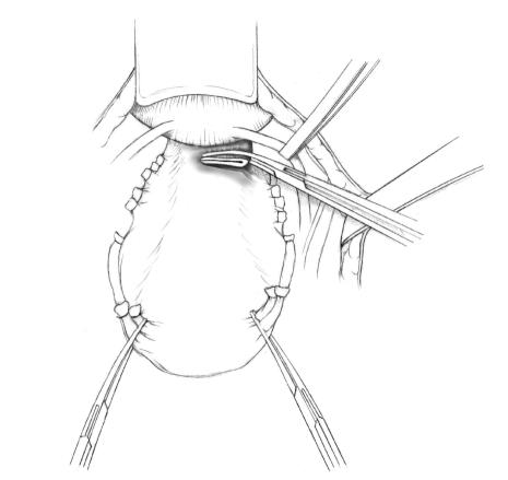 https://cdn.ncbi.nlm.nih.gov/pmc/blobs/9e78/2939408/b7ce93b07ce5/OGI2010-587610.015.jpg