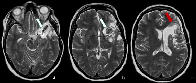 https://cdn.ncbi.nlm.nih.gov/pmc/blobs/9e7b/10569986/19dcb0676f38/gr5.jpg