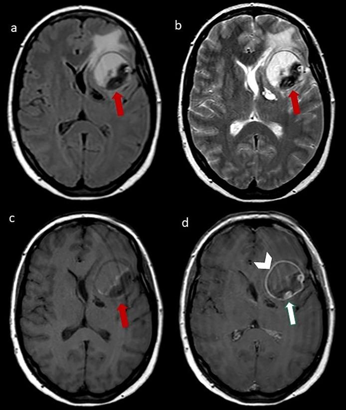 https://cdn.ncbi.nlm.nih.gov/pmc/blobs/9e7b/10569986/ef4e1afd023d/gr2.jpg