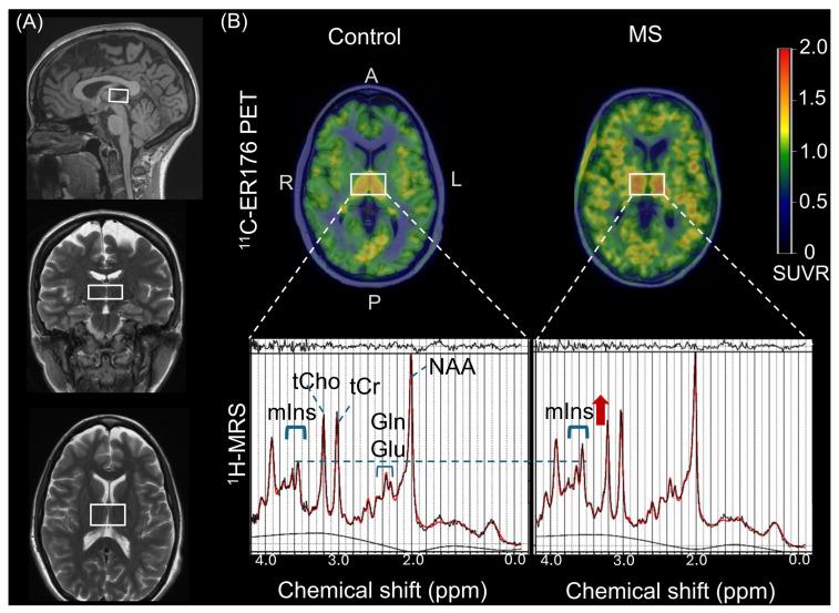 https://cdn.ncbi.nlm.nih.gov/pmc/blobs/9e7d/12428814/01878302c165/ijms-26-08656-g002.jpg
