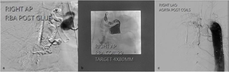 https://cdn.ncbi.nlm.nih.gov/pmc/blobs/9e98/12316662/5e3fad043b52/42155_2025_519_Fig5_HTML.jpg