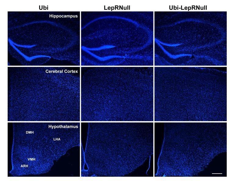 https://cdn.ncbi.nlm.nih.gov/pmc/blobs/9e99/6384028/7bbfa4a1e77c/elife-40970-resp-fig6.jpg