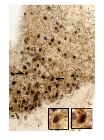 https://cdn.ncbi.nlm.nih.gov/pmc/blobs/9e99/6384028/d751642c6cd1/elife-40970-resp-fig1.jpg